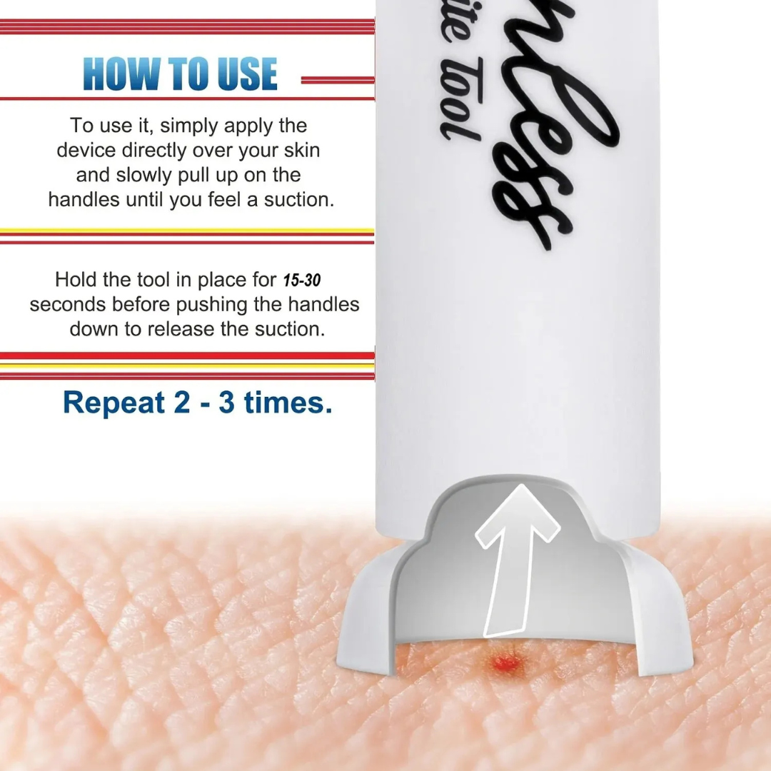 StingFree™- Your Pocket Sized Bug Bite Hero